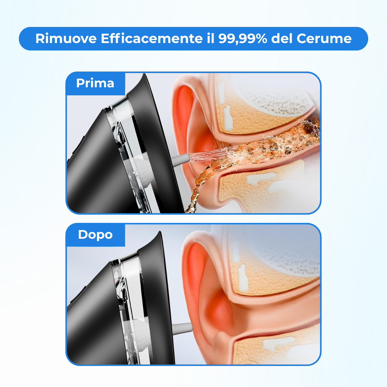 Vita Bianca™ – Pulizia Auricolare Intelligente